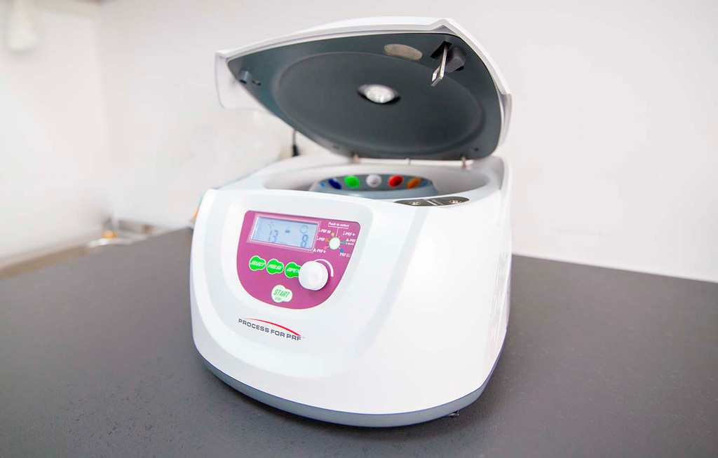 Centrifugado plaquetas Clínica Pardo
