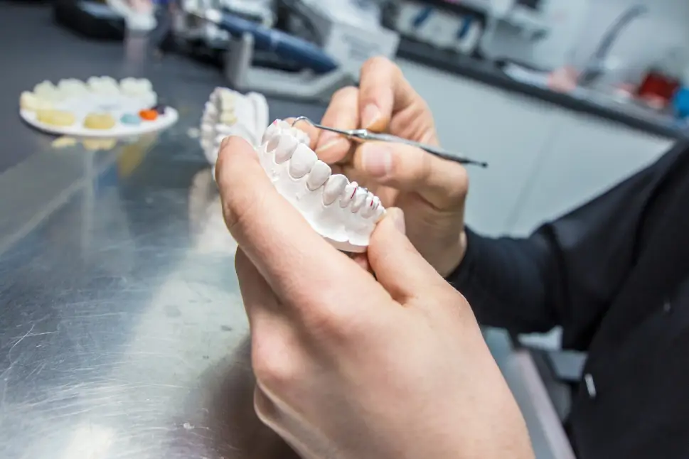 Implantes dentales Ronda Ida Pardo